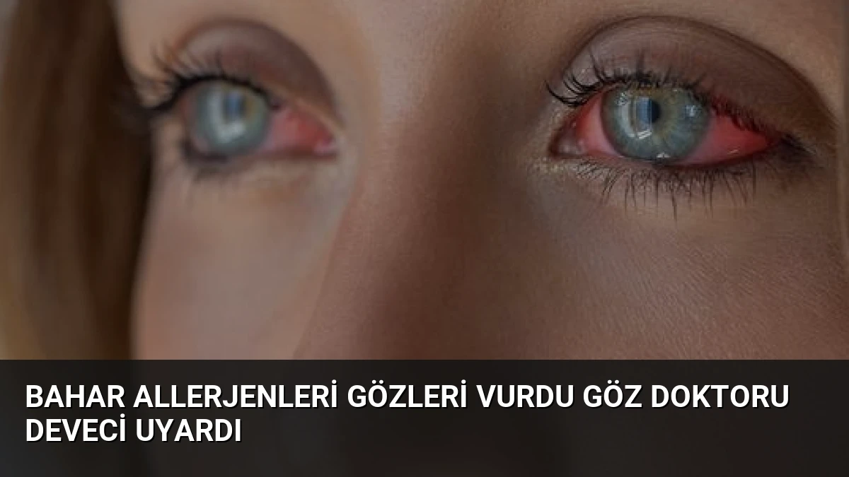 Bahar Allerjenleri Gözleri Vurdu Göz Doktoru Deveci Uyardı