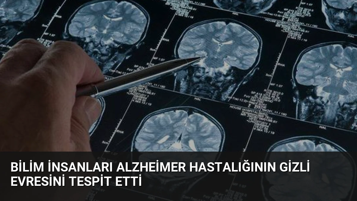Bilim İnsanları Alzheimer Hastalığının Gizli Evresini Tespit Etti