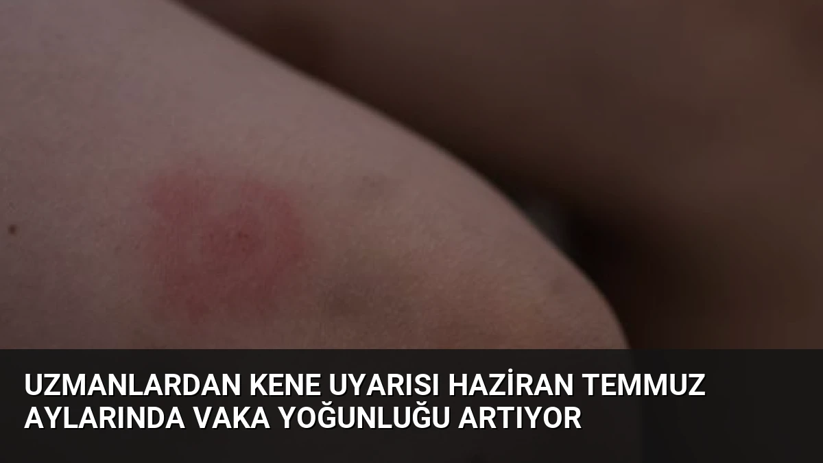 Uzmanlardan Kene Uyarısı Haziran Temmuz Aylarında Vaka Yoğunluğu Artıyor