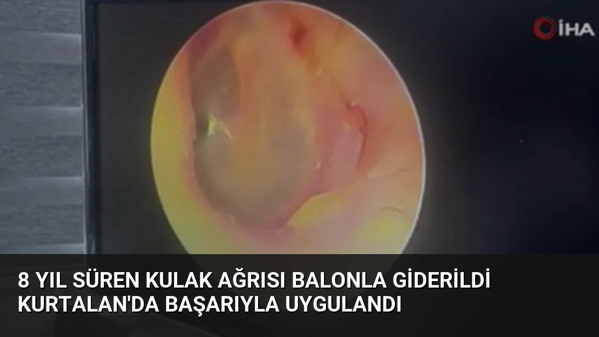 8 Yıl Süren Kulak Ağrısı Balonla Giderildi Kurtalan’da Başarıyla Uygulandı
