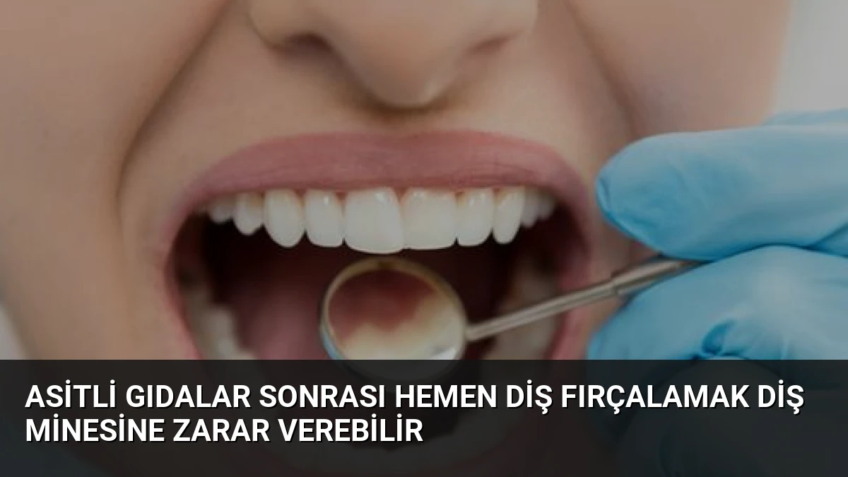 Asitli Gıdalar Sonrası Hemen Diş Fırçalamak Diş Minesine Zarar Verebilir